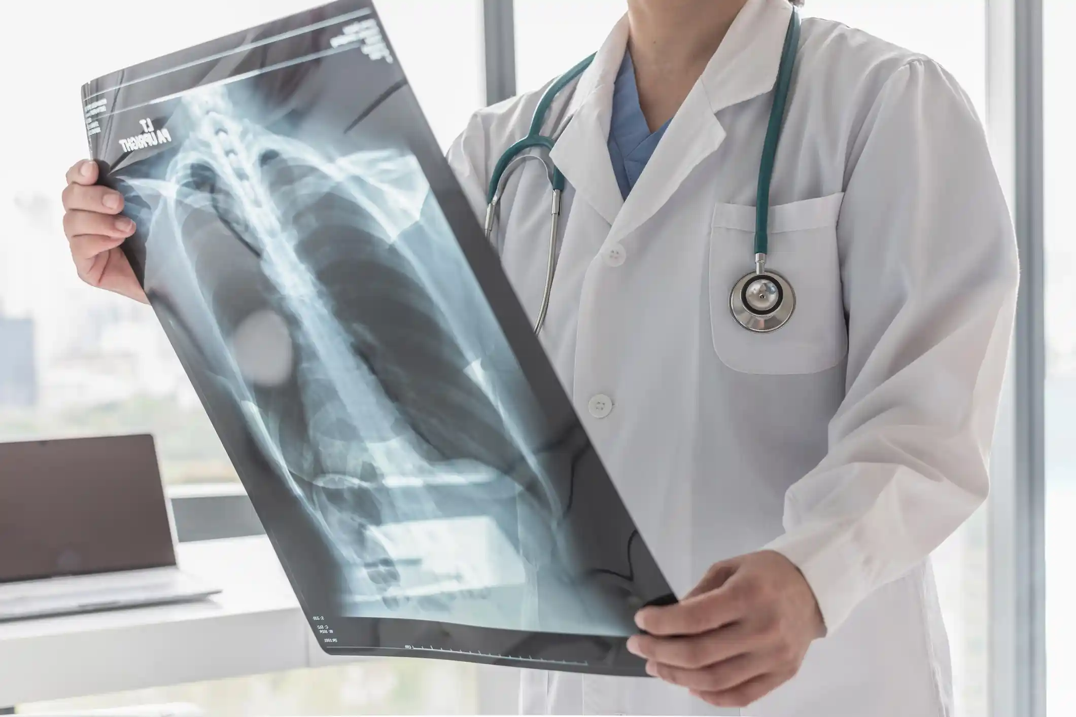 Radiografias Digitais do Corpo Inteiro
